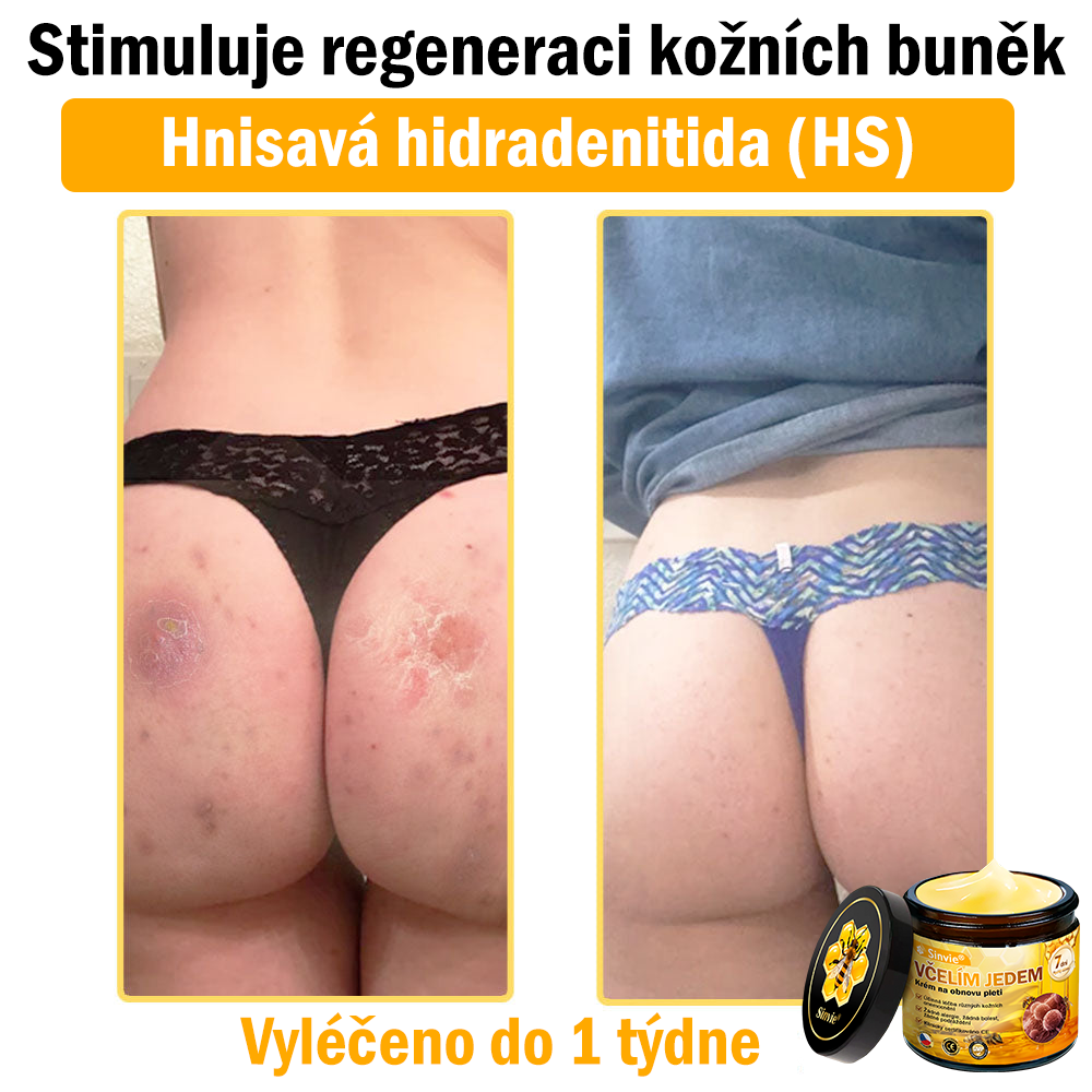 💛 Sinvie® Krém na obnovu pleti s včelím jedem ✅CE schváleno 👨⚕ Doporučeno dermatology - 50ml