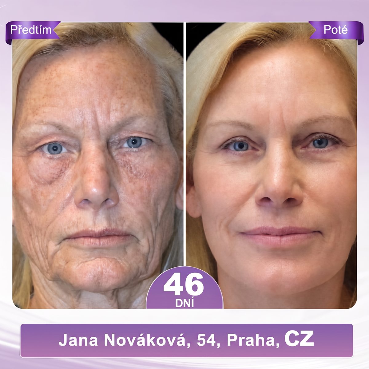 🇨🇿🇨🇿🇨🇿  PuraCure® PDRN multipeptidový masážní tělový krém s roll-on aplikátorem ✨Anti-age péče • Hydratace • Zpevnění • Lifting • Regenerace • Sjednocení tónu pokožky