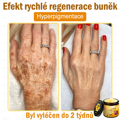 🐝Doporučení dermatologa  ✨Sinvie® Krém na obnovu pleti s včelím jedem 🔥 Český vývoj, výroba a dodávka v České republice - 50ml