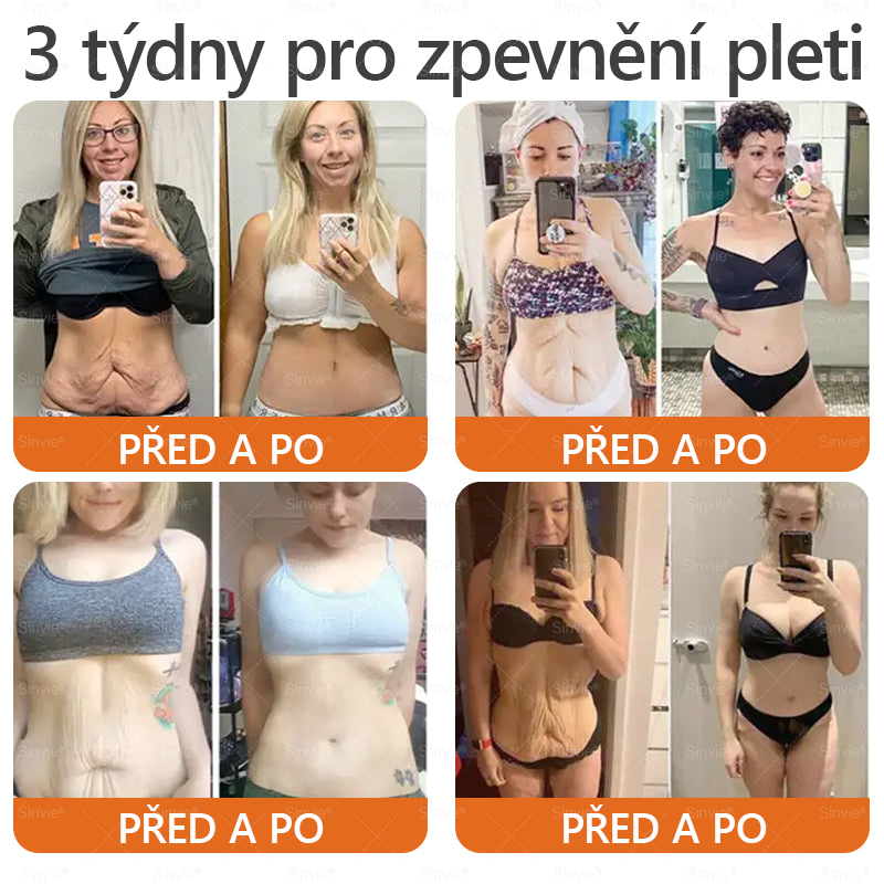 🐝Doporučení dermatologa  ✨Sinvie® Krém na obnovu pleti s včelím jedem 🔥 Český vývoj, výroba a dodávka v České republice - 50ml