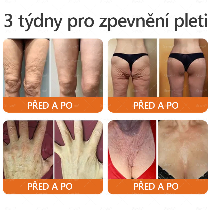 💛💛 Sinvie® Krém na obnovu pleti s včelím jedem ✅CE schváleno 👨‍⚕ Doporučeno dermatology - 50ml