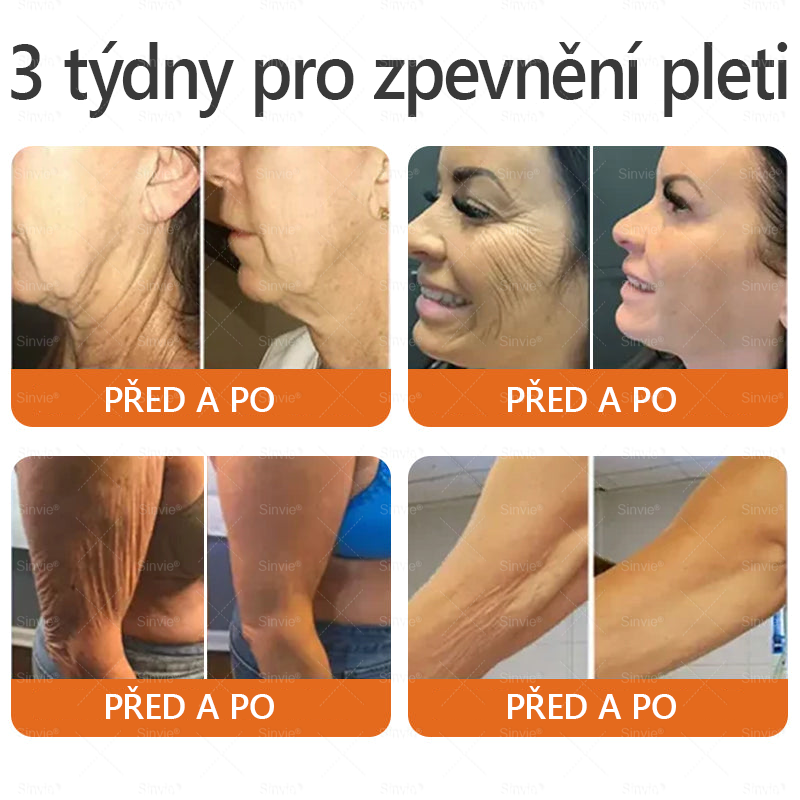 🐝Doporučení dermatologa  ✨Sinvie® Krém na obnovu pleti s včelím jedem 🔥 Český vývoj, výroba a dodávka v České republice - 50ml