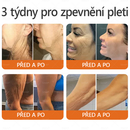 🐝Doporučení dermatologa  ✨Sinvie® Krém na obnovu pleti s včelím jedem 🔥 Český vývoj, výroba a dodávka v České republice - 50ml