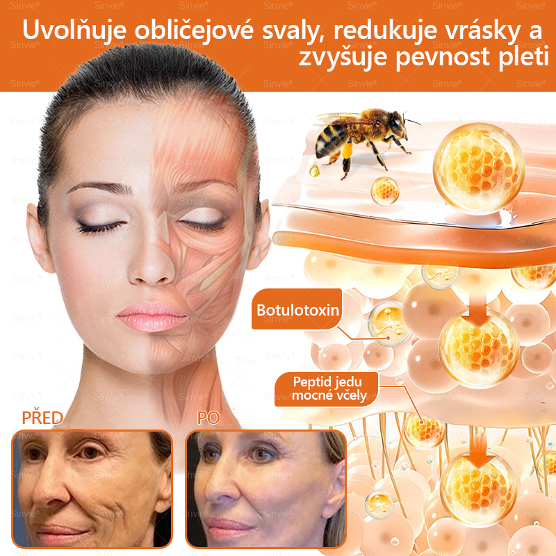🐝Doporučení dermatologa  ✨Sinvie® Krém na obnovu pleti s včelím jedem 🔥 Český vývoj, výroba a dodávka v České republice - 50ml