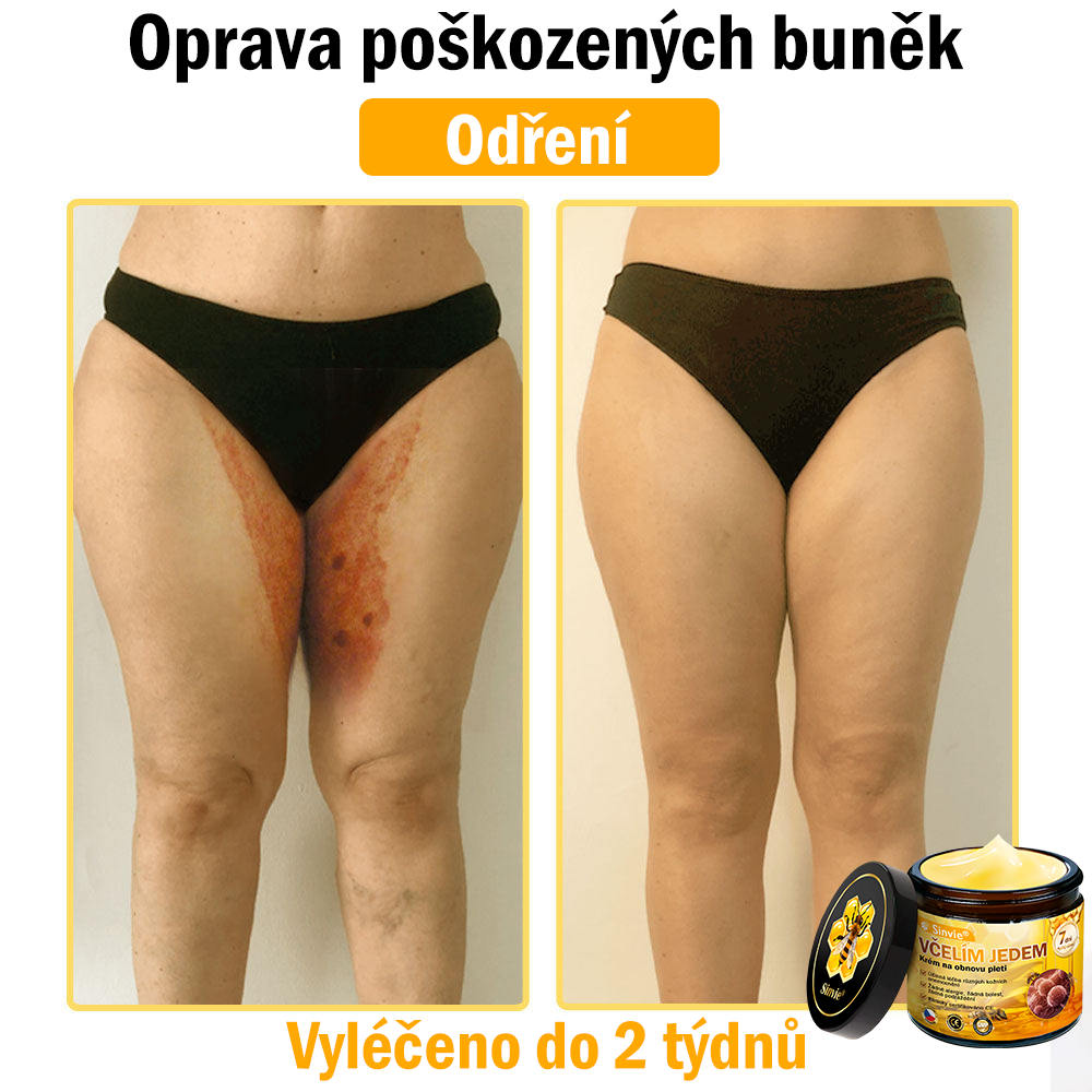 💛💛 Sinvie® Krém na obnovu pleti s včelím jedem ✅CE schváleno 👨‍⚕ Doporučeno dermatology - 50ml