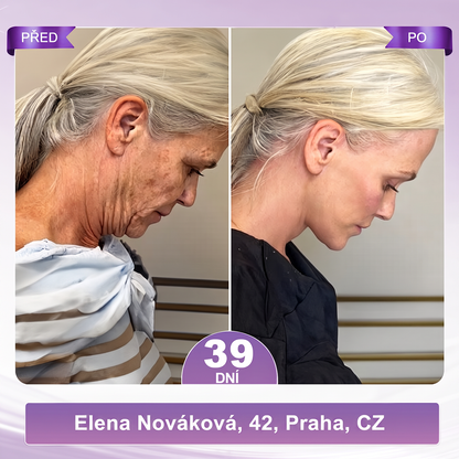 🇨🇿🇨🇿🇨🇿  PuraCure® PDRN multipeptidový masážní tělový krém s roll-on aplikátorem ✨Anti-age péče • Hydratace • Zpevnění • Lifting • Regenerace • Sjednocení tónu pokožky