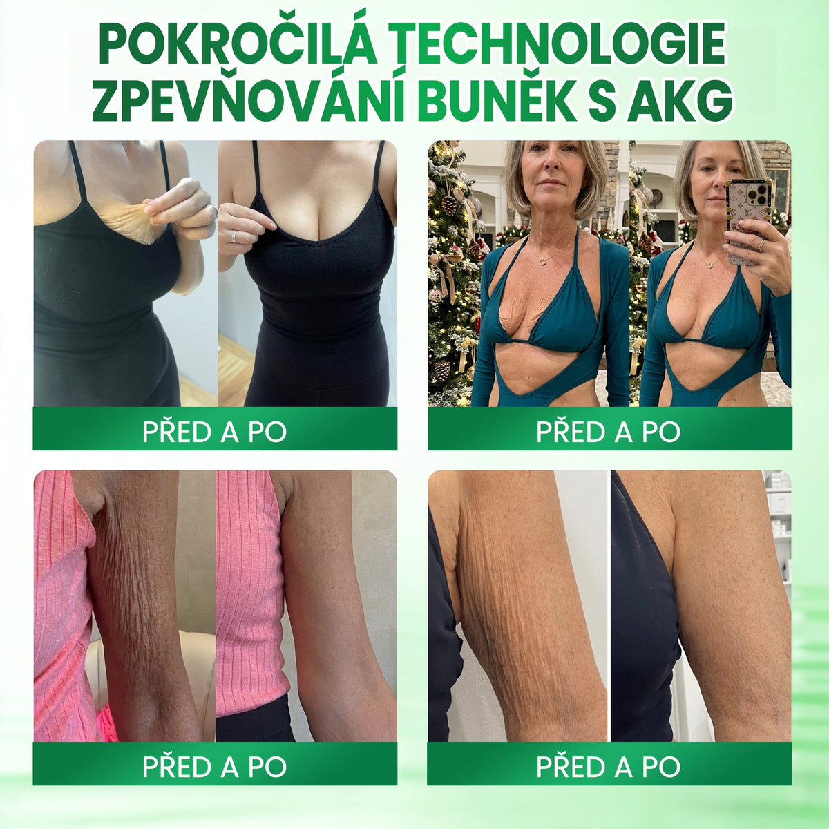 ✨Medistart® AKG POKROČILÝ ZPEVŇUJÍCÍ TĚLOVÝ KRÉM – 💧 Pro pevnější, hladší a pružnější pokožku.