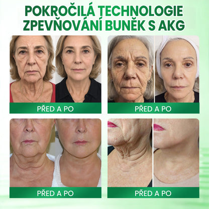 ✨Medistart® AKG POKROČILÝ ZPEVŇUJÍCÍ TĚLOVÝ KRÉM – 💧 Pro pevnější, hladší a pružnější pokožku.