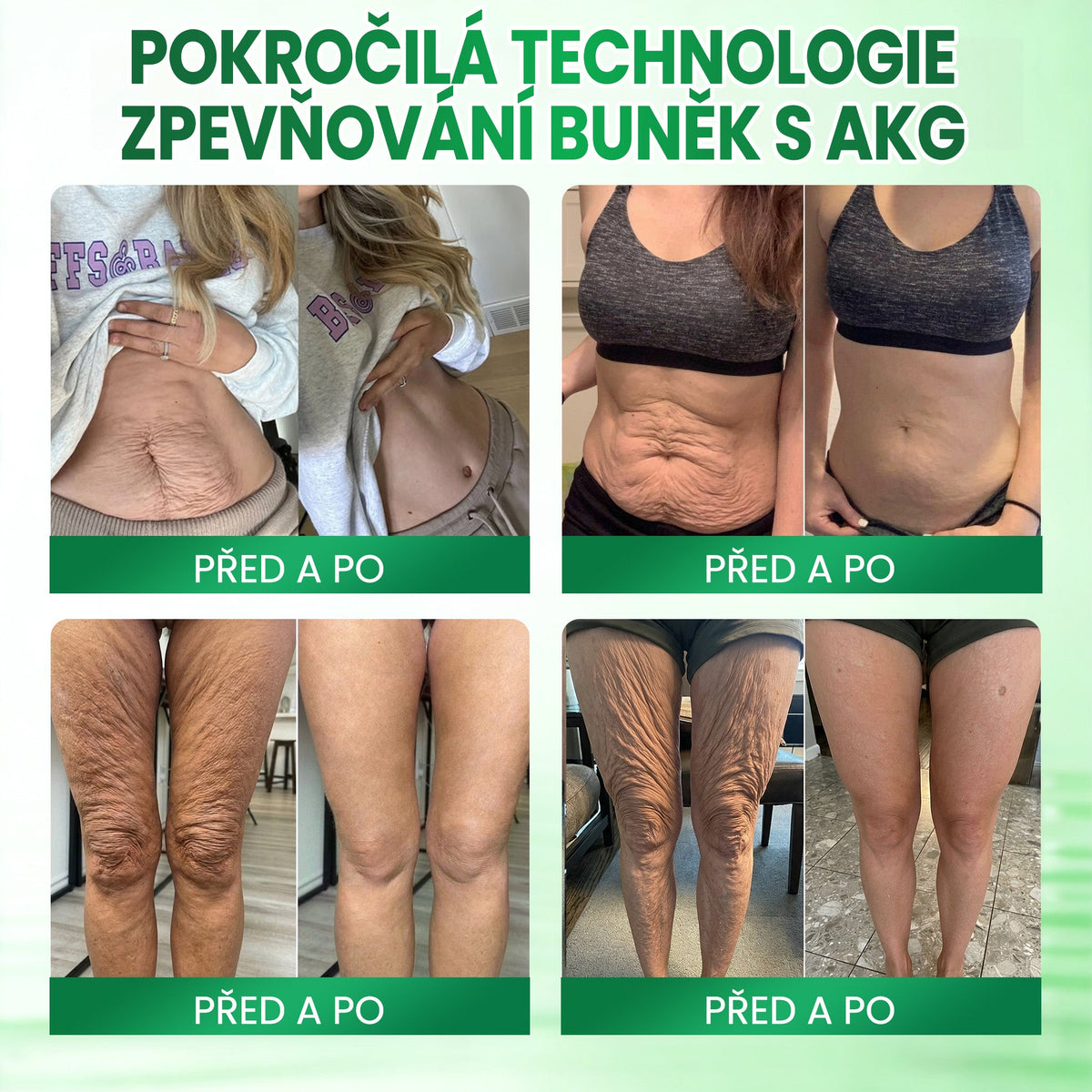 ✨Medistart® AKG POKROČILÝ ZPEVŇUJÍCÍ TĚLOVÝ KRÉM – 💧 Pro pevnější, hladší a pružnější pokožku.