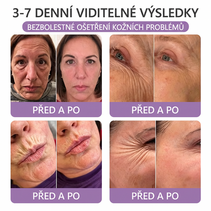 🇨🇿🇨🇿🇨🇿  PuraCure® PDRN multipeptidový masážní tělový krém s roll-on aplikátorem ✨Anti-age péče • Hydratace • Zpevnění • Lifting • Regenerace • Sjednocení tónu pokožky