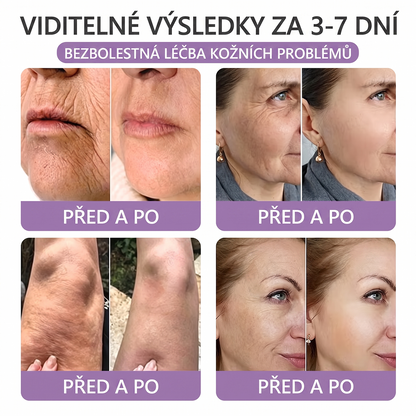 🇨🇿🇨🇿🇨🇿  PuraCure® PDRN multipeptidový masážní tělový krém s roll-on aplikátorem ✨Anti-age péče • Hydratace • Zpevnění • Lifting • Regenerace • Sjednocení tónu pokožky