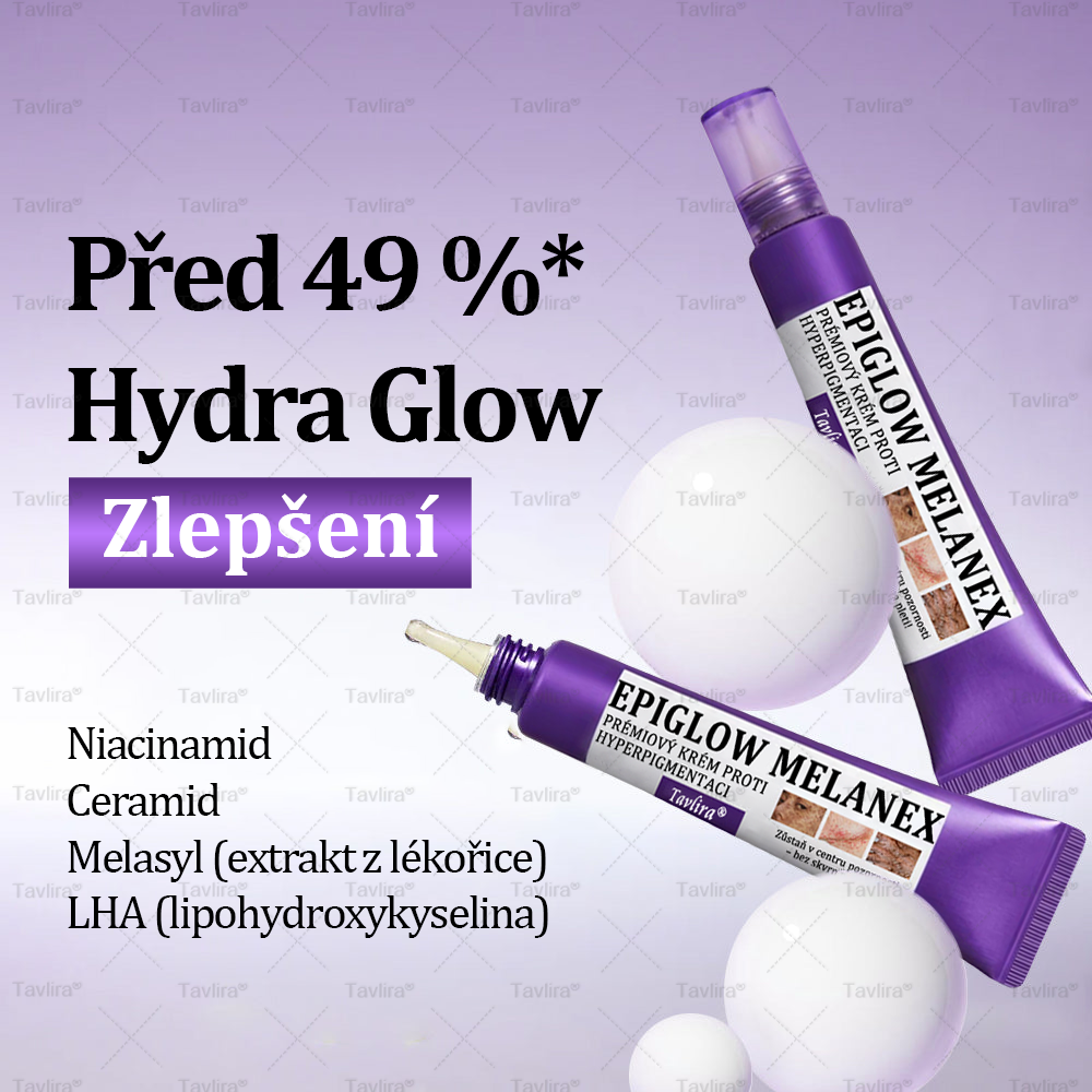 💜💜Tavlira® EPIGLOW MelanEX prémiový krém proti hyperpigmentaci | ✅Schválené zdravotníckym oddelením České republiky
