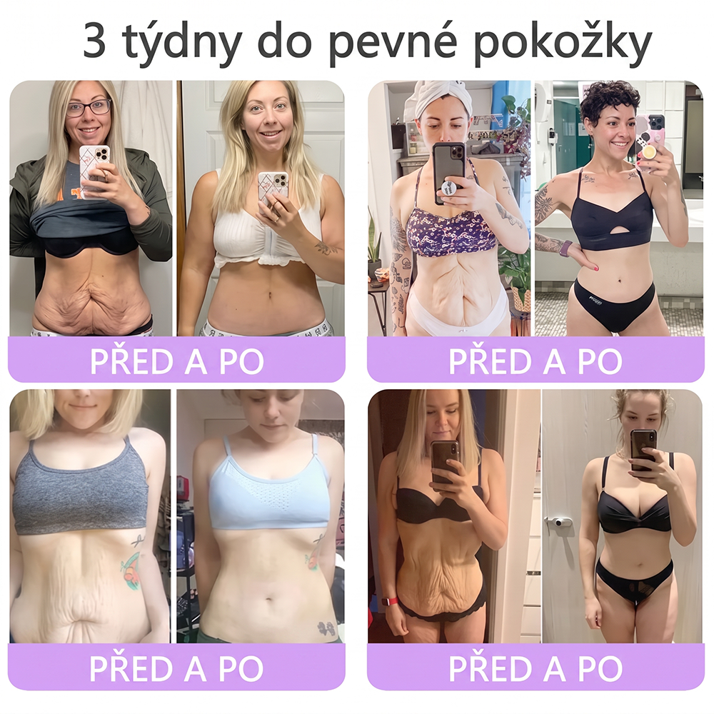 🇨🇿🇨🇿🇨🇿  PuraCure® PDRN multipeptidový masážní tělový krém s roll-on aplikátorem ✨Anti-age péče • Hydratace • Zpevnění • Lifting • Regenerace • Sjednocení tónu pokožky