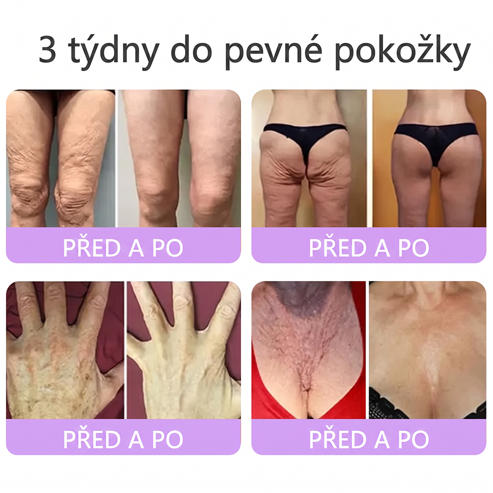 🇨🇿🇨🇿🇨🇿  PuraCure® PDRN multipeptidový masážní tělový krém s roll-on aplikátorem ✨Anti-age péče • Hydratace • Zpevnění • Lifting • Regenerace • Sjednocení tónu pokožky