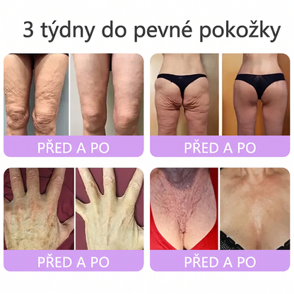 🇨🇿🇨🇿🇨🇿  PuraCure® PDRN multipeptidový masážní tělový krém s roll-on aplikátorem ✨Anti-age péče • Hydratace • Zpevnění • Lifting • Regenerace • Sjednocení tónu pokožky