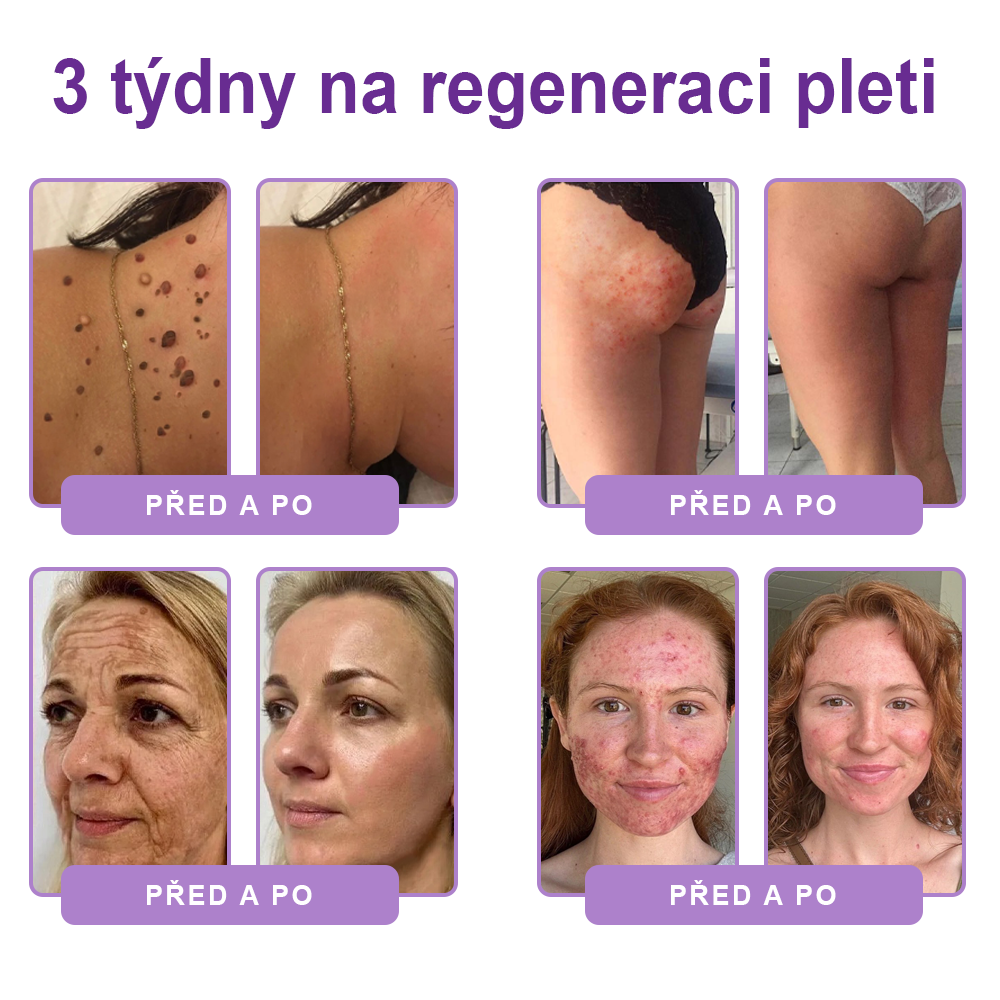 🇨🇿🇨🇿🇨🇿  PuraCure® PDRN multipeptidový masážní tělový krém s roll-on aplikátorem ✨Anti-age péče • Hydratace • Zpevnění • Lifting • Regenerace • Sjednocení tónu pokožky