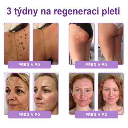 🇨🇿🇨🇿🇨🇿  PuraCure® PDRN multipeptidový masážní tělový krém s roll-on aplikátorem ✨Anti-age péče • Hydratace • Zpevnění • Lifting • Regenerace • Sjednocení tónu pokožky