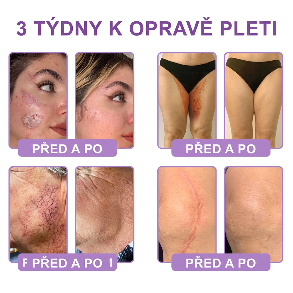 🇨🇿🇨🇿🇨🇿  PuraCure® PDRN multipeptidový masážní tělový krém s roll-on aplikátorem ✨Anti-age péče • Hydratace • Zpevnění • Lifting • Regenerace • Sjednocení tónu pokožky