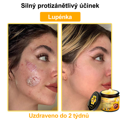 💛💛 Sinvie® Krém na obnovu pleti s včelím jedem ✅CE schváleno 👨‍⚕ Doporučeno dermatology - 50ml