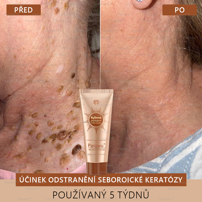 💟 Parowu™ Bělící a Odstraňující Skvrny Maska -🍀Přírodní složky trvale odstraňují pigmentové skvrny, stařecké skvrny, pihy a sluneční skvrny.
