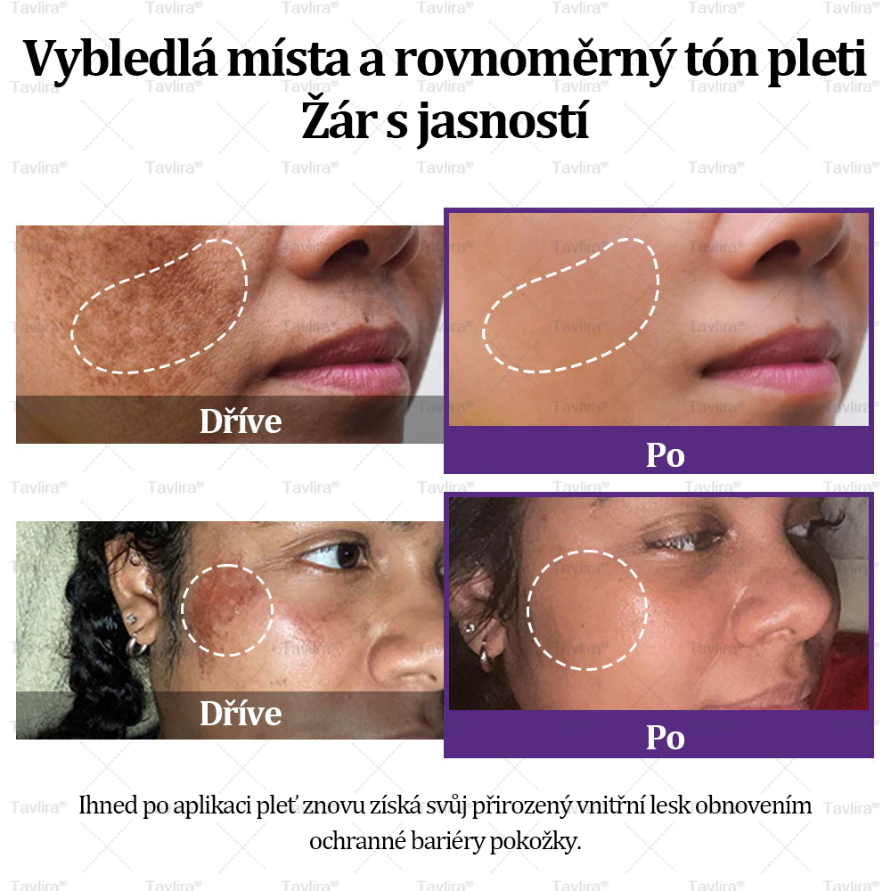 💜💜Tavlira® EPIGLOW MelanEX prémiový krém proti hyperpigmentaci | ✅Schválené zdravotníckym oddelením České republiky