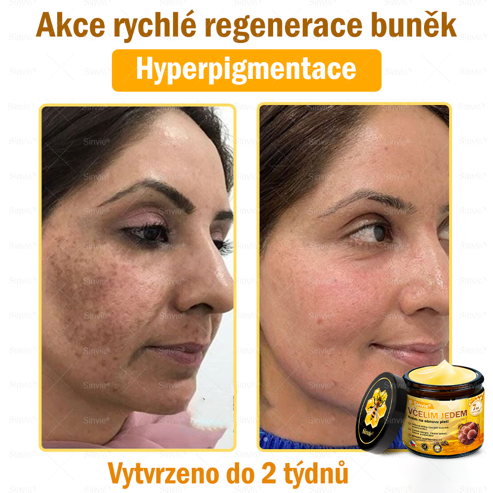 🐝Doporučení dermatologa  ✨Sinvie® Krém na obnovu pleti s včelím jedem 🔥 Český vývoj, výroba a dodávka v České republice - 50ml
