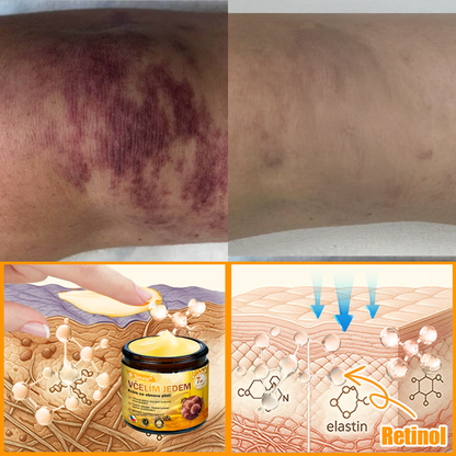 💛💛 Sinvie® Krém na obnovu pleti s včelím jedem ✅CE schváleno 👨‍⚕ Doporučeno dermatology - 50ml