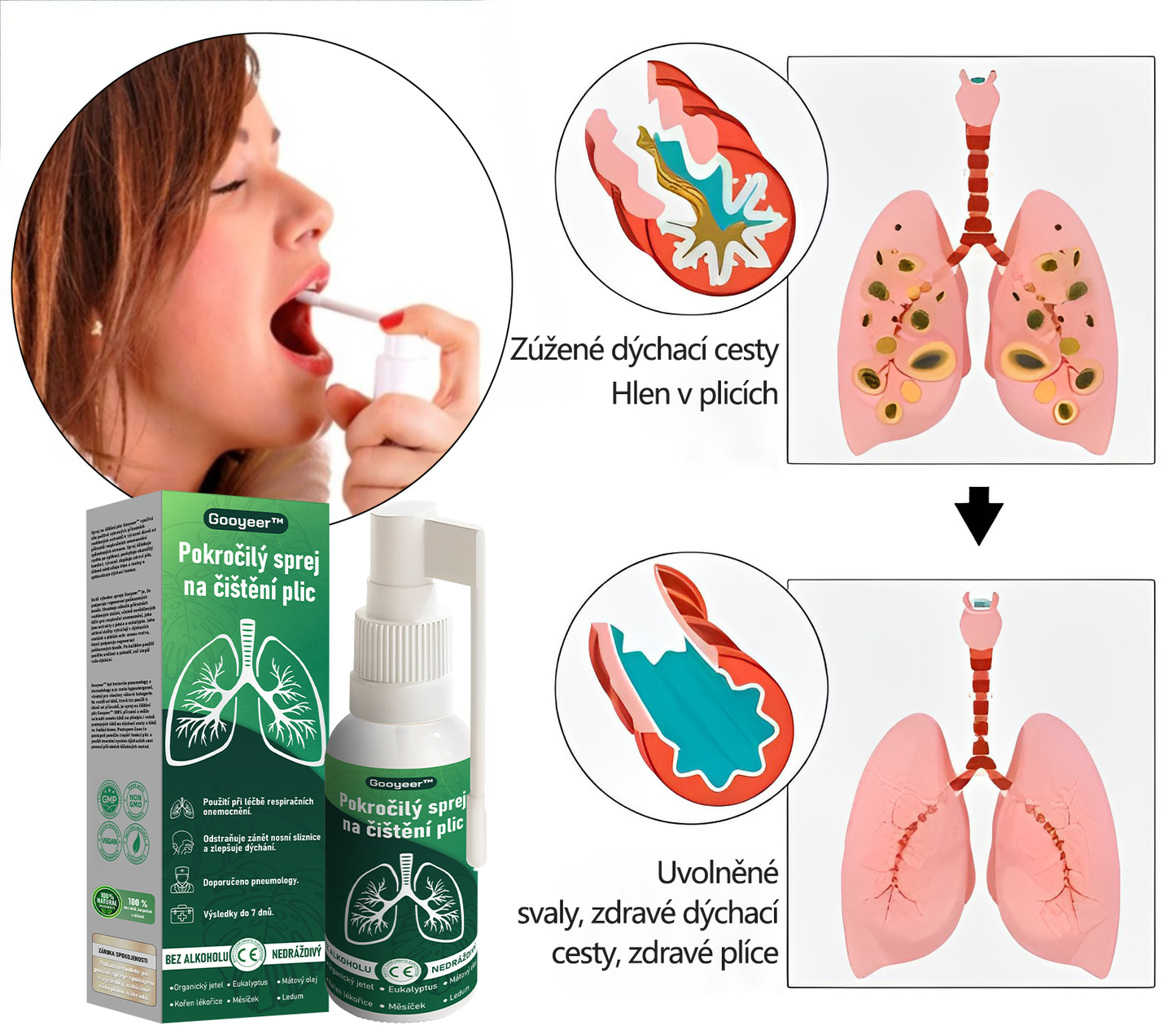 🍀𝐆𝐨𝐨𝐲𝐞𝐞𝐫™ Pokročilý sprej na čištění plic -🧑‍⚕️ Podporuje zdraví plic, průdušek a dutin, napomáhá zdraví dýchacího systému a usnadňuje dýchání.