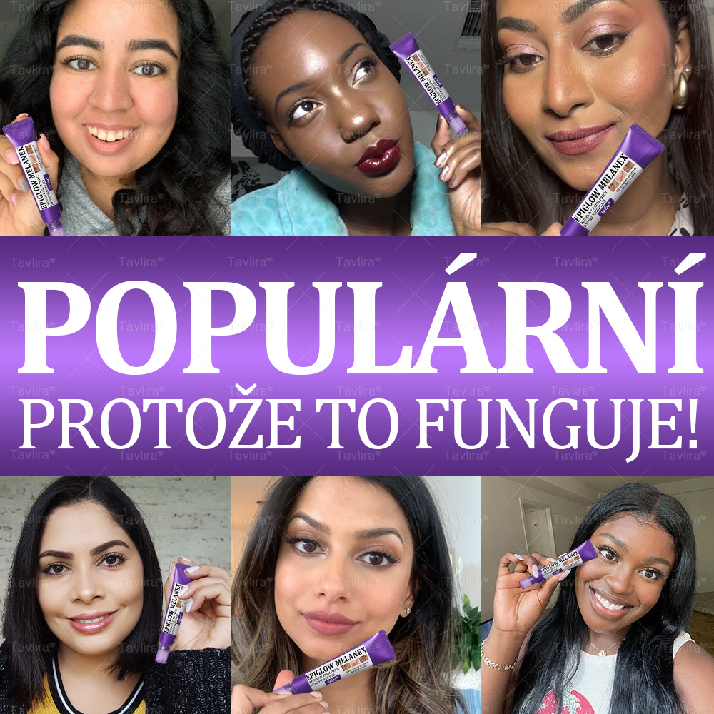 💜💜Tavlira® EPIGLOW MelanEX prémiový krém proti hyperpigmentaci | ✅Schválené zdravotníckym oddelením České republiky