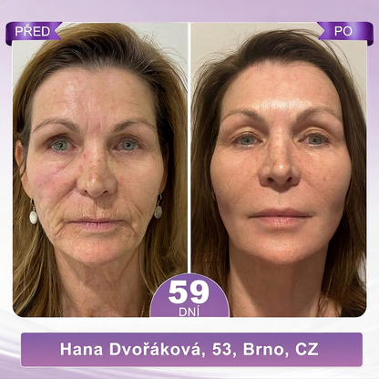 🇨🇿🇨🇿🇨🇿  PuraCure® PDRN multipeptidový masážní tělový krém s roll-on aplikátorem ✨Anti-age péče • Hydratace • Zpevnění • Lifting • Regenerace • Sjednocení tónu pokožky
